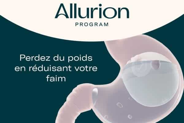 ballon gastrique allurion paris indications comment ca marche cabinet adn chirurgie bariatrique obesite paris