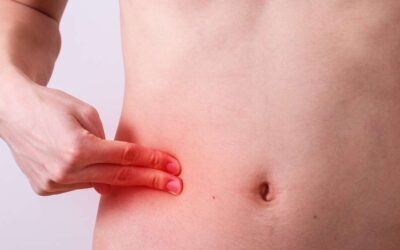 Appendicite aiguë : reconnaître les signes et réagir vite
