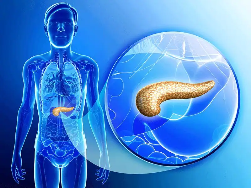 acute-pancreatitis