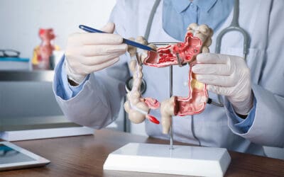 Transit après une chirurgie du côlon : à quoi s&rsquo;attendre