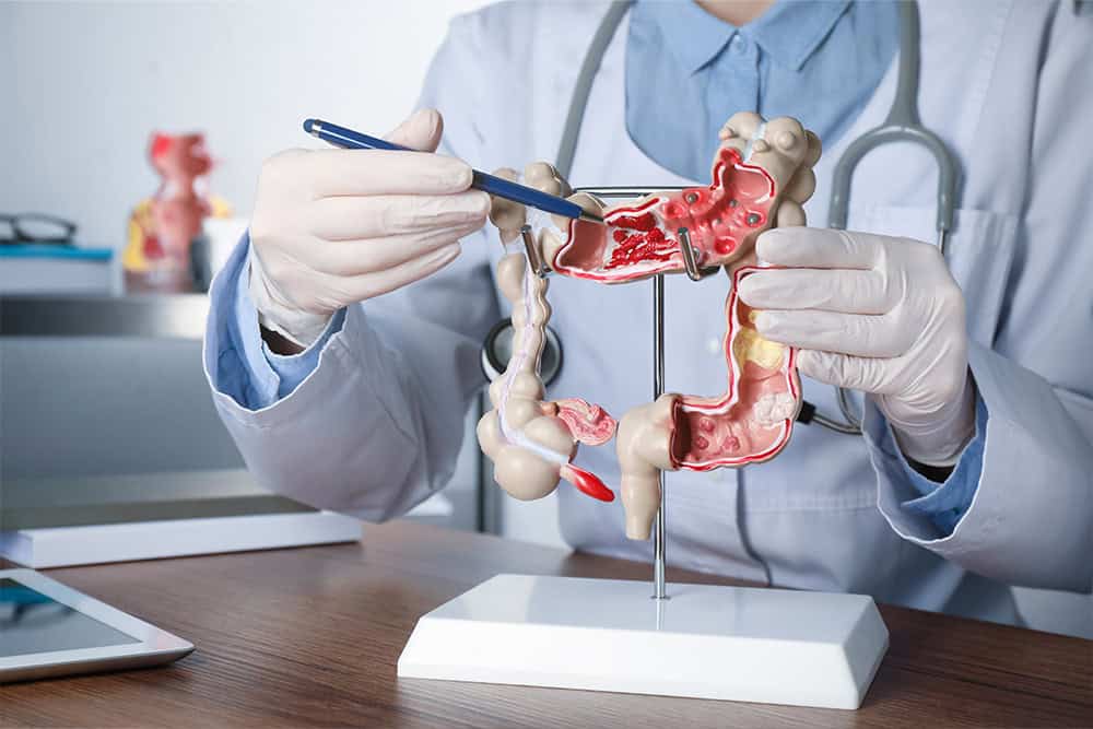 chirurgie_colon_rectum